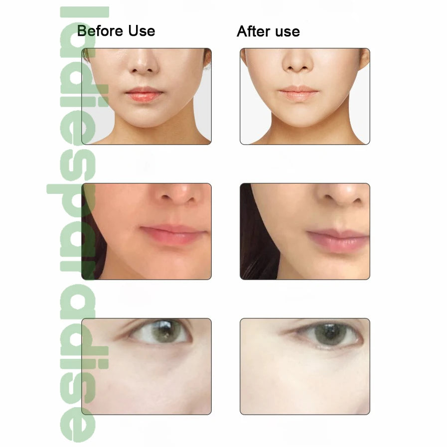 Microcurrent Skin Lifting & Anti-Wrinkle Facial Device