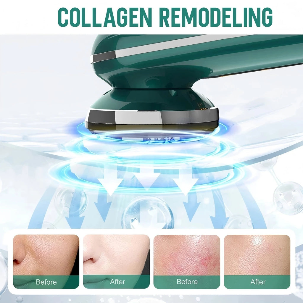 Microcurrent Facial & Neck Device - LED Photon Rejuvenation