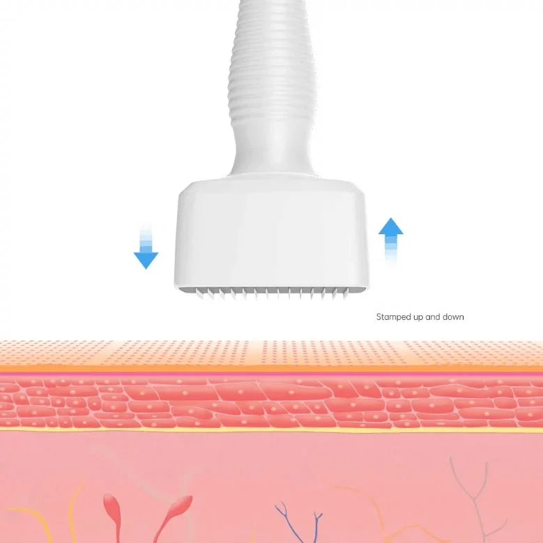 140A 0.25mm Derma Stamp Microneedling - Adjustable Titanium Needle Length - Beard Growth, Scalp Hair