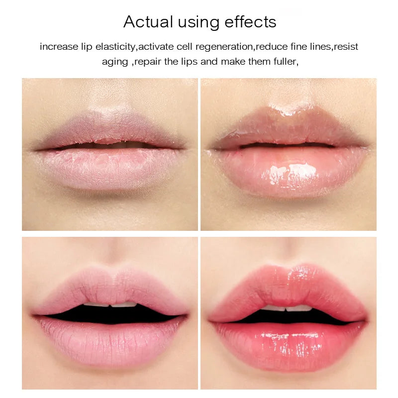 17ml Instant Volumizing Lip Plumper Serum