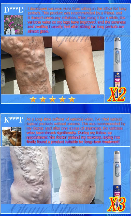 Leg Phototherapy Pen – Relieves Swelling, Heaviness & Promotes Circulation
