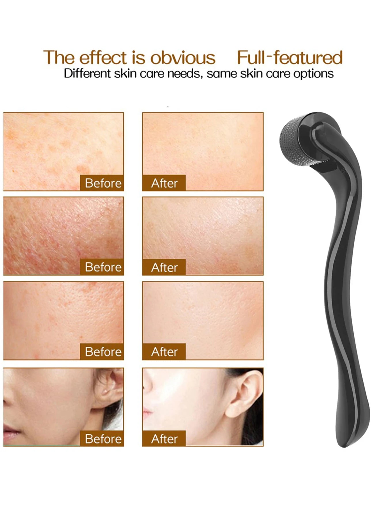 540-Pin Titanium Microneedle Derma Roller