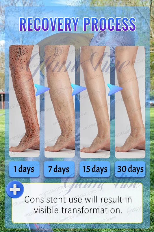Leg Phototherapy Pen – Relieves Swelling, Heaviness & Promotes Circulation
