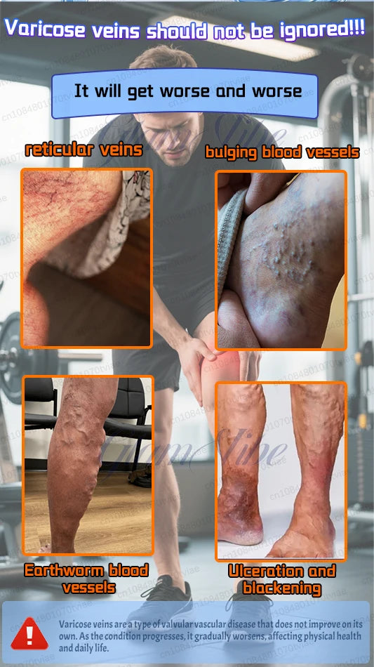 Leg Phototherapy Pen – Relieves Swelling, Heaviness & Promotes Circulation