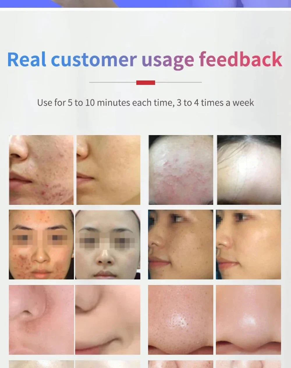 Skin Moisturizing Mist Sprayer