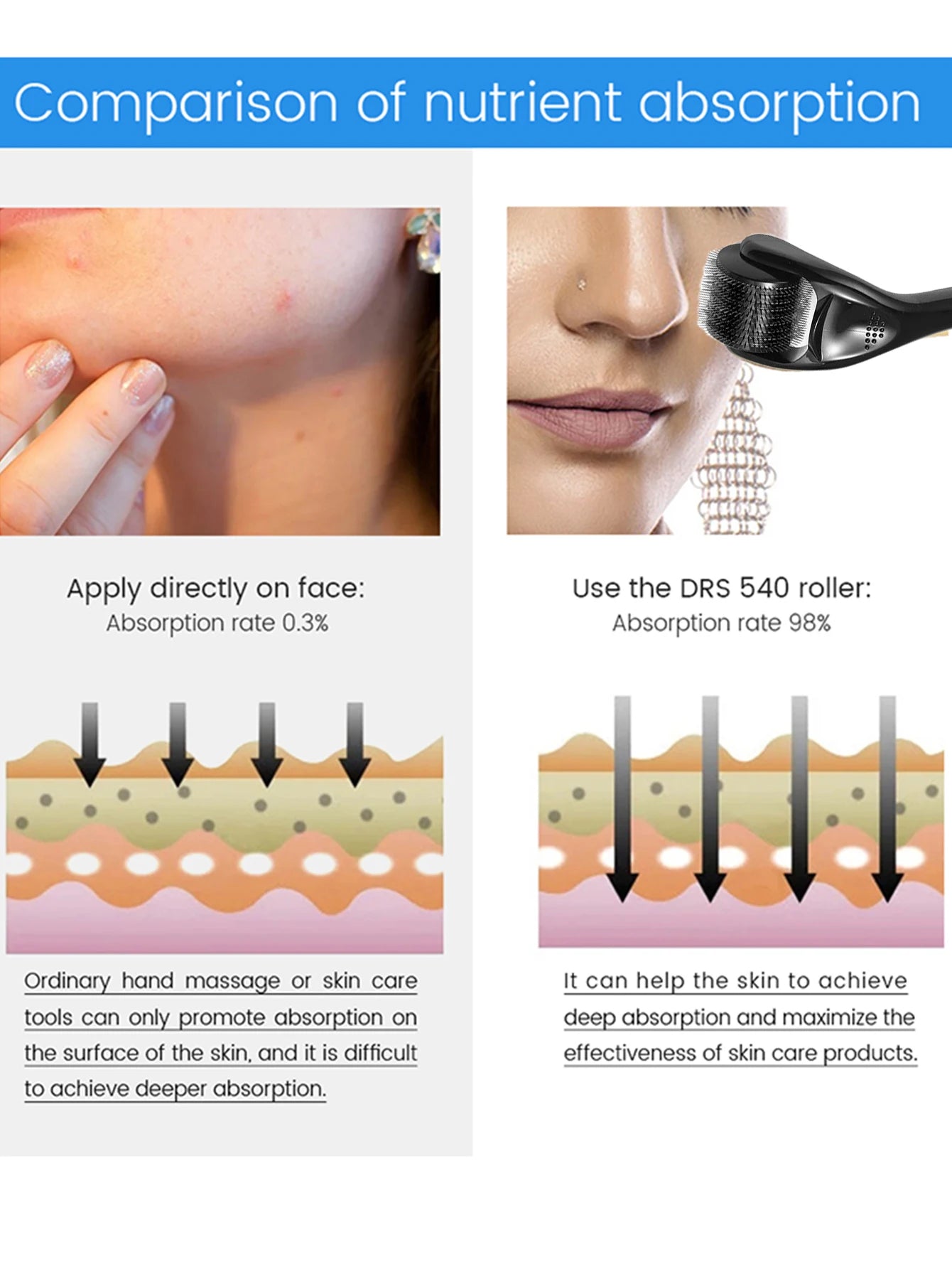 540-Pin Titanium Microneedle Derma Roller
