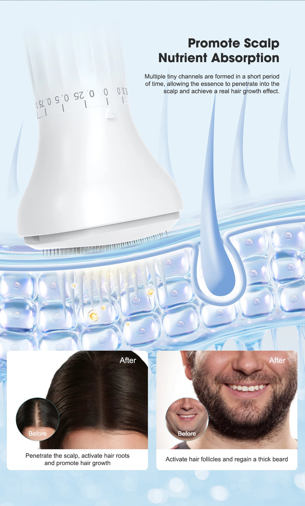 Microneedle Derma Stamp for Home Use – 0.25mm, Face & Scalp