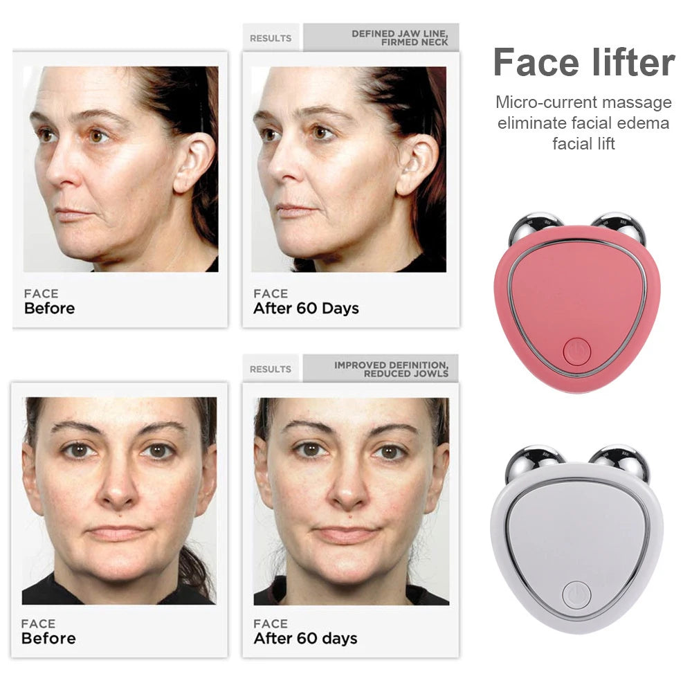 Face Firming Microcurrent Roller - Skin Rejuvenation Device